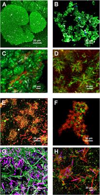 Matrix glycoconjugate characterization in multispecies biofilms and bioaggregates from the environment by means of fluorescently-labeled lectins